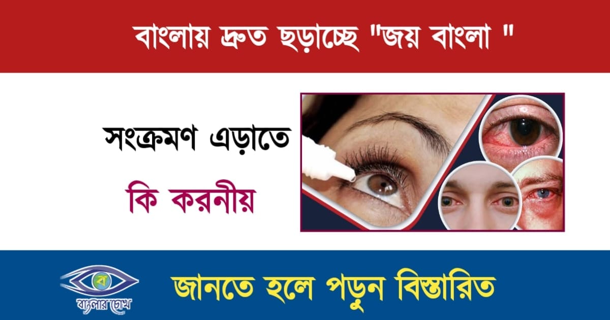 Conjunctivitis (জয় বাংলা)